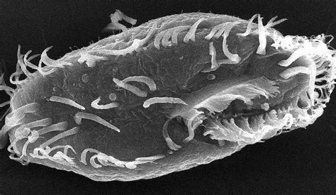  Acanthokeras! The Ciliated Wonder That Makes Its Own House