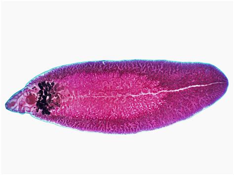  Zollingeri Fluke:  A Microscopic Master of Deception Lurking Within its Freshwater Host!